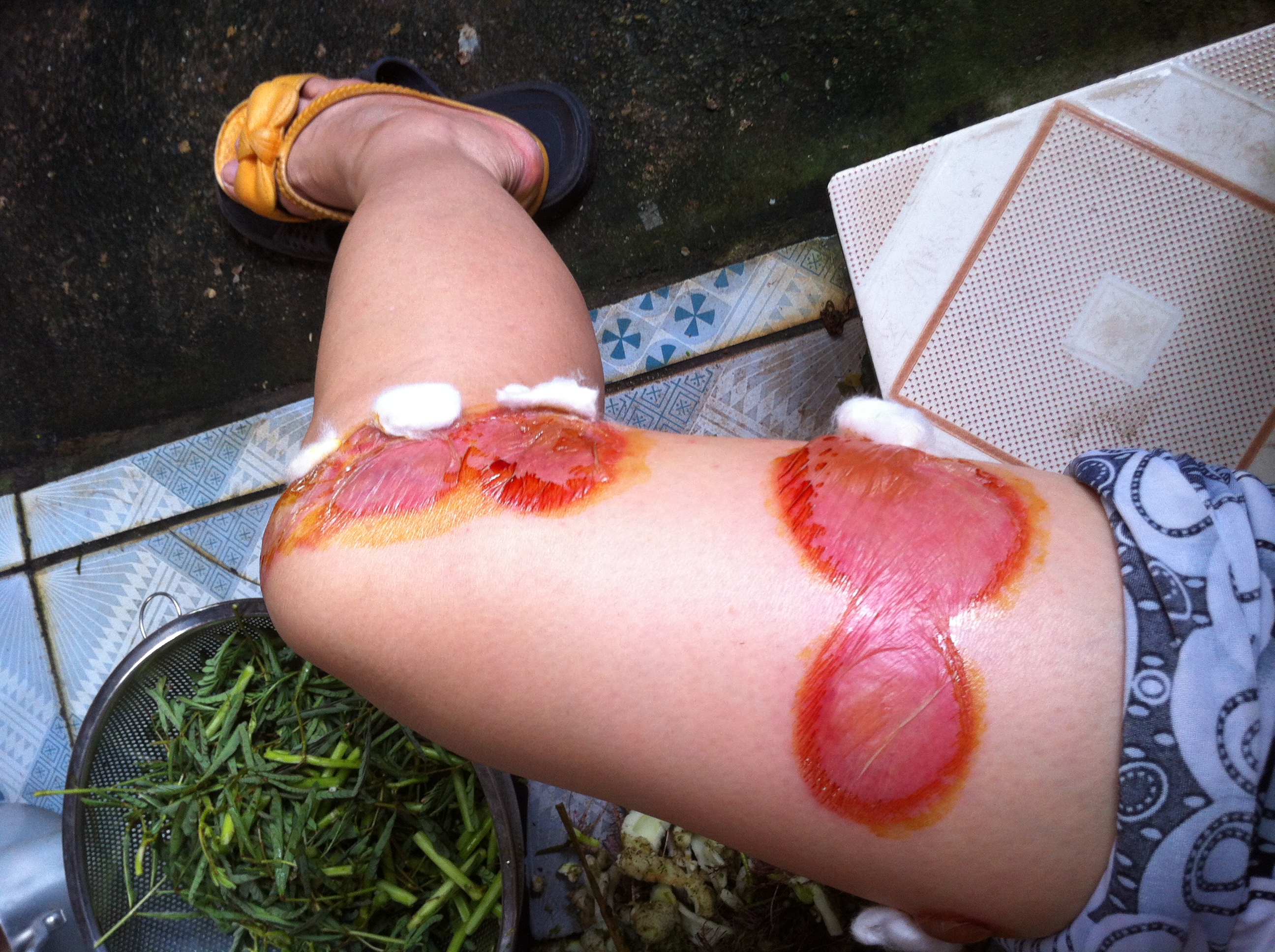 Sức khoẻ - Làm đẹp - Xuất hiện bọ xít hút máu người tại Hà Nội (Hình 2).