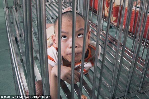 Tin thế giới - Hình ảnh trẻ em Việt Nam bị chất độc da cam lên báo Anh (Hình 2).