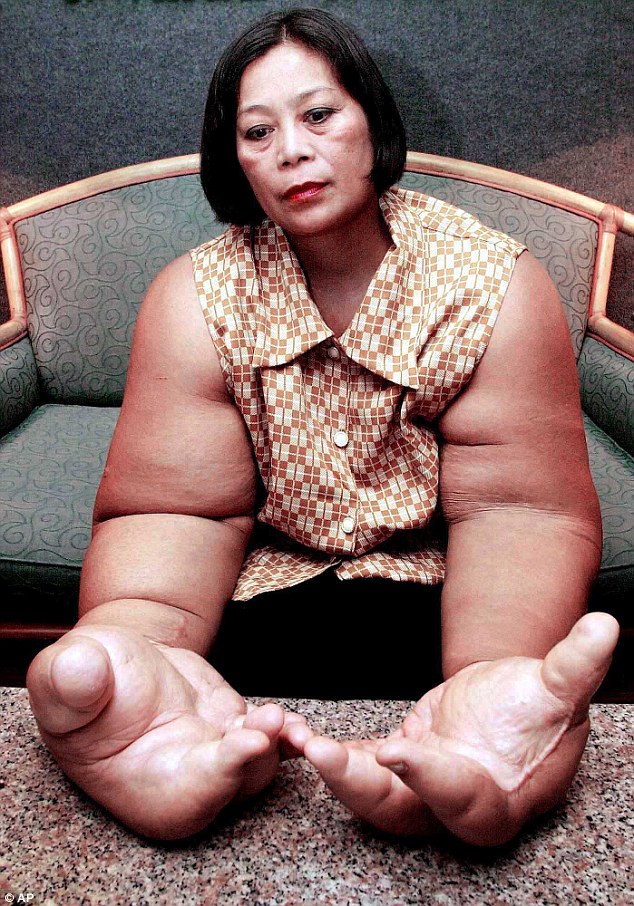 Phát hoảng người phụ nữ có đôi tay khổng lồ nhất thế giới