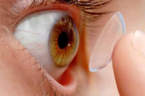 Nữ sinh bị mù mắt vì đeo kính áp tròng suốt 6 tháng không vệ sinh
