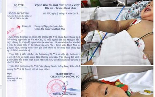 Tin trong nước - Bộ trưởng Bộ Y tế kêu gọi hỗ trợ bé 2 tuổi bị rắn cắn