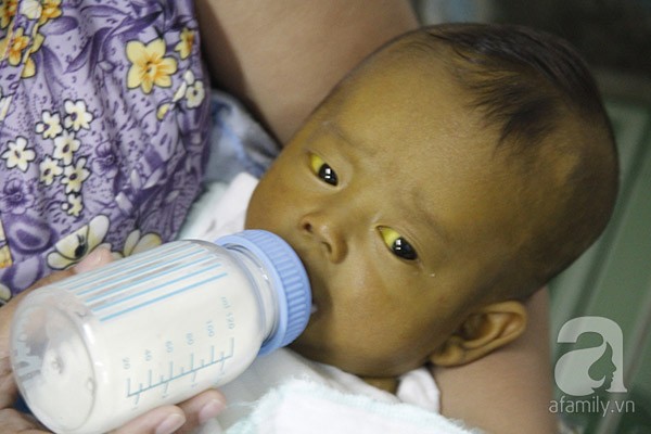 Sức khoẻ - Làm đẹp - Xót thương bé trai 3 tháng tuổi mang nhiều căn bệnh quái ác (Hình 2).