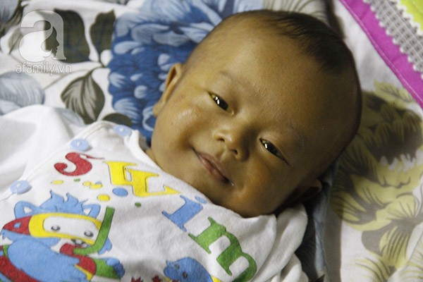 Sức khoẻ - Làm đẹp - Xót thương bé trai 3 tháng tuổi mang nhiều căn bệnh quái ác (Hình 4).