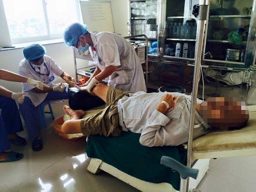 Sức khoẻ - Làm đẹp - Thủ phạm đáng sợ khiến nhiều người Việt mất chân chỉ trong 1 tuần (Hình 2).
