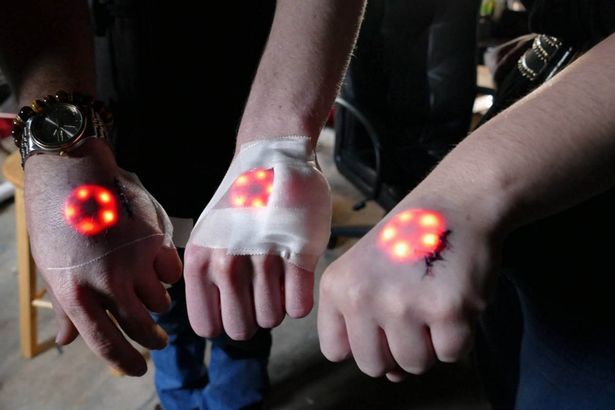 Tin thế giới - Cấy đèn Led vào da, con người có đang dần Robot hoá? (Hình 2).