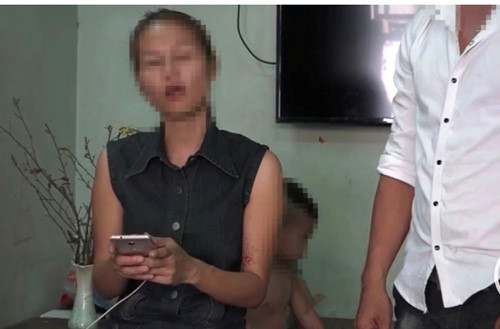 Tin tức - TP HCM: 'Quà Tết' phát nổ, hai mẹ con bị bỏng nặng