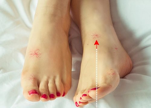 Sức khoẻ - Làm đẹp - Có những dấu hiệu này ở chân chứng tỏ bạn đang mắc bệnh nguy hiểm (Hình 6).