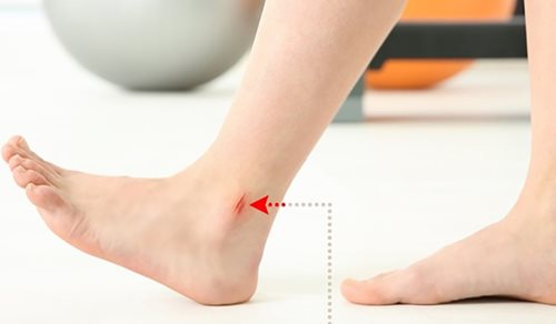 Sức khoẻ - Làm đẹp - Có những dấu hiệu này ở chân chứng tỏ bạn đang mắc bệnh nguy hiểm (Hình 9).
