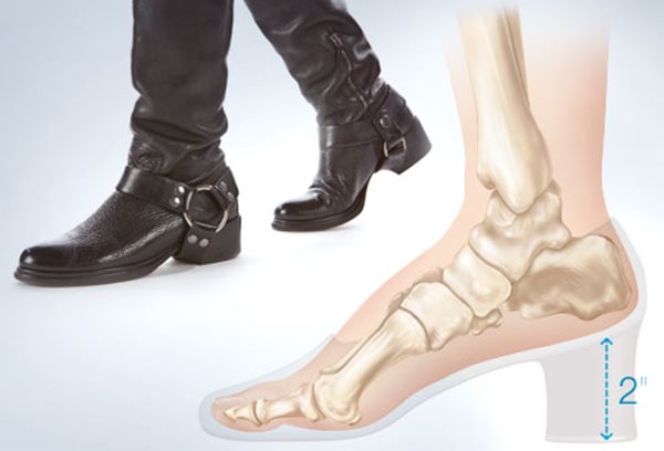Sức khoẻ - Làm đẹp - Những kiểu giày dép gây hại cho chân chị em cần loại bỏ hoặc hạn chế sử dụng (Hình 7).