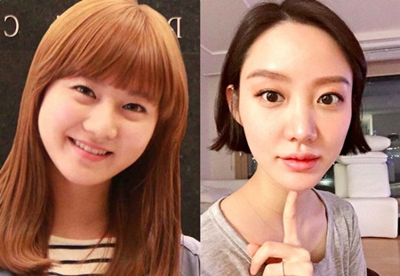 Tin tức - 3 sao nữ xứ Hàn thừa nhận hối hận sau khi phẫu thuật thẩm mỹ (Hình 2).