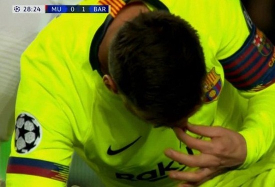 Bóng đá - Cận cảnh gương mặt bầm dập của Messi sau pha va chạm với hậu vệ MU (Hình 4).