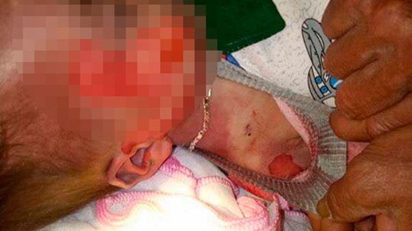 Tin tức - Vụ bé 15 tháng tuổi tử vong với nhiều vết thương 'lạ': BV khẳng định không làm rơi bệnh nhi