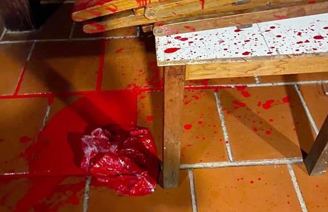 An ninh - Hình sự - Chủ nhà hàng ở Hội An tố bị người lạ mặt 'khủng bố' bằng mắm tôm, sơn