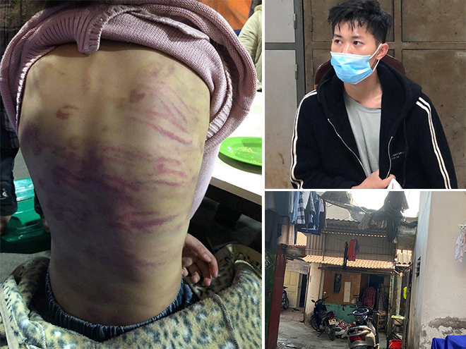 An ninh - Hình sự - Vụ bé gái 12 tuổi ở Hà Nội nghi bị bạo hành, hiếp dâm: Mẹ đẻ và gã nhân tình đối diện với án phạt gì?