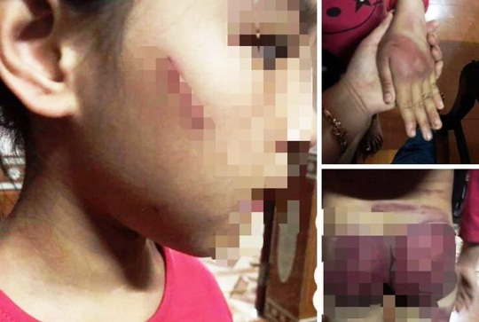 Pháp luật - Vụ bé gái 8 tuổi bị bố bạo hành dã man: Bất ngờ chia sẻ của bà nội