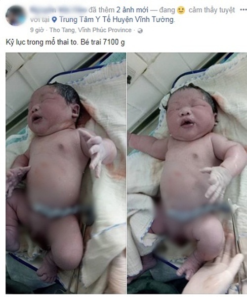 Cộng đồng mạng - Chiêm ngưỡng em bé sơ sinh nặng 7,1kg mới chào đời ở Vĩnh Phúc