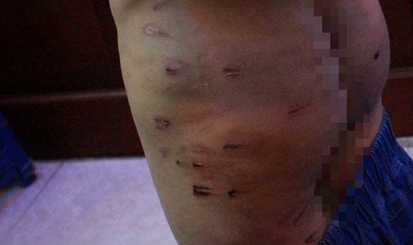 Tin tức - Hà Nội: Bé trai 9 tuổi nghi bị bố đẻ dùng dây điện bạo hành dã man (Hình 3).