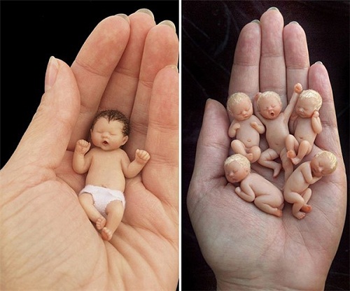Đời sống - Ngỡ ngàng trước hình ảnh những em bé sơ sinh nhỏ hơn cả bàn tay siêu đáng yêu (Hình 14).
