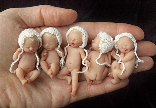 Đời sống - Ngỡ ngàng trước hình ảnh những em bé sơ sinh nhỏ hơn cả bàn tay siêu đáng yêu (Hình 4).
