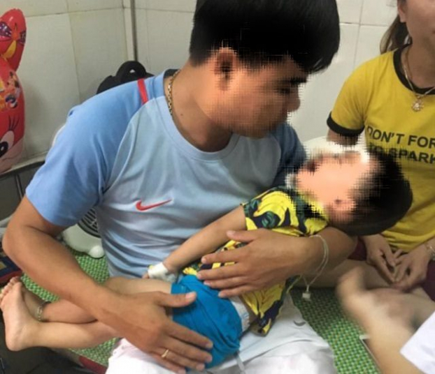 Tin tức - Nghệ An: Bé 2 tuổi bị chó nhà nuôi cắn rách mặt, tổn thương mắt