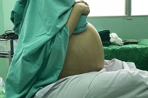 Tin tức - Cô gái 20 tuổi mang khối u 18kg lầm tưởng bị béo bụng