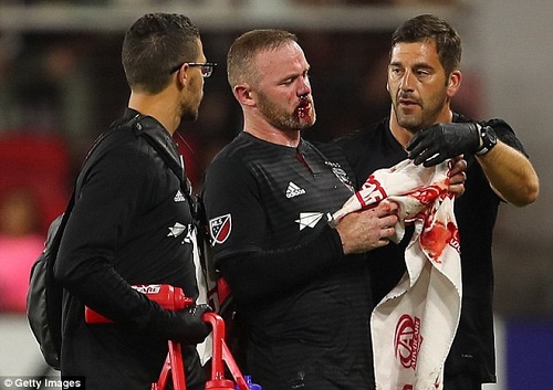 Tin tức - Rooney chảy máu, khâu 5 mũi sau khi ghi bàn thắng đầu tiên cho DC United