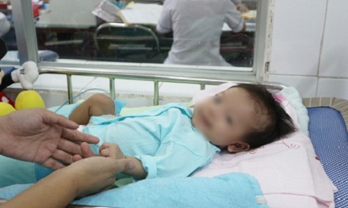 Tin tức - Cứu bé gái 2 tháng tuổi mắc bệnh hiếm gặp hình thành từ lúc bào thai (Hình 2).
