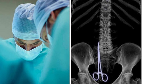 Tin tức - Hy hữu: Bác sĩ bỏ quên kéo phẫu thuật trong bụng bệnh nhân suốt 6 tháng 