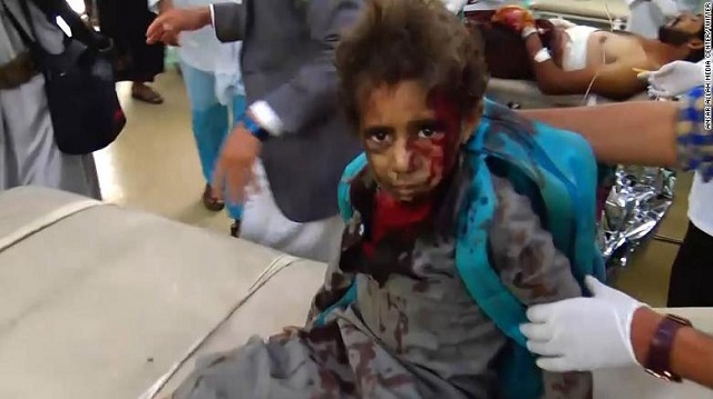 Tin thế giới - Xe buýt chở học sinh Yemen trúng tên lửa, ít nhất 43 người thiệt mạng