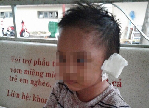 Tin tức - Bình Dương: Bé trai 3 tuổi nghi bị mẹ ruột và “cha dượng” bạo hành