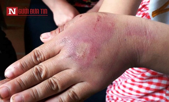 Tin trong nước - Vụ bố đánh con gái 8 tuổi dã man ở Thanh Hóa: Xử phạt hành chính 2,5 triệu đồng (Hình 2).