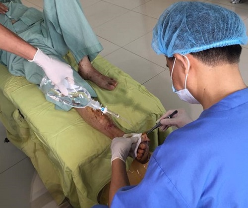 Tin tức - Lười uống thuốc, bệnh nhân tiểu đường phải cắt bỏ ngón chân