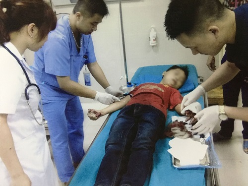 Tin tức - Thái rau chuối giúp bố mẹ, bé trai bị đứt lìa ngón tay