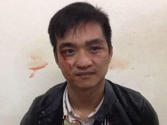 Tin trong nước - Hé lộ bất ngờ về nhân thân của nam thanh niên táo tợn cướp tiệm vàng ở Hà Nội