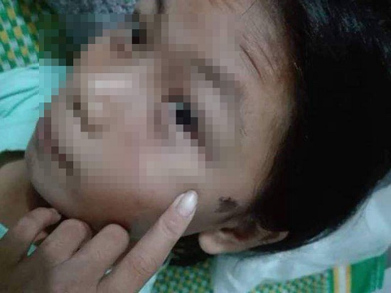 Tin trong nước - Nghi trộm 50.000 đồng, công an viên đánh bé gái 12 tuổi nhập viện (Hình 2).