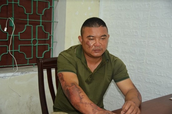 Pháp luật - Khởi tố đối tượng mang can xăng 10 lít đốt nhà người tình tại Nghệ An
