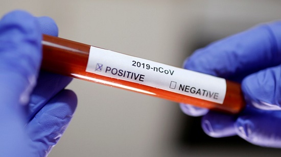 Tin trong nước - Bộ Y tế công bố thêm 2 bệnh nhân nhiễm Covid-19, nâng tổng số lên 118 ca