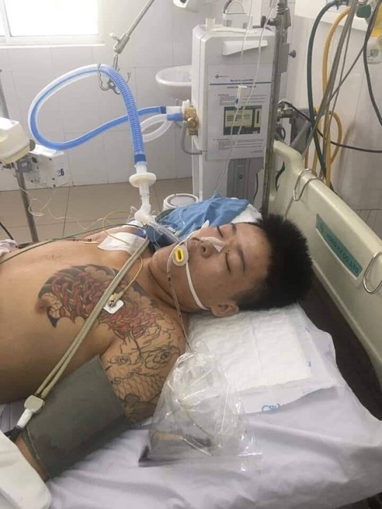 Tin trong nước - Sự thật về vết bầm trên trên ngực nghi can cấp cứu tại bệnh viện Đà Nẵng