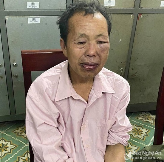 Tin trong nước - Nghệ An: Bị phát hiện, 'ông trùm' buôn ma túy sử dụng dao súng tấn công cảnh sát