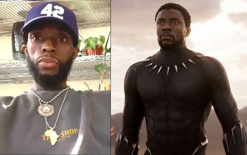 Tin tức giải trí - 'Black Panther' khiến fan lo lắng vì khuôn mặt gầy gò, hốc hác