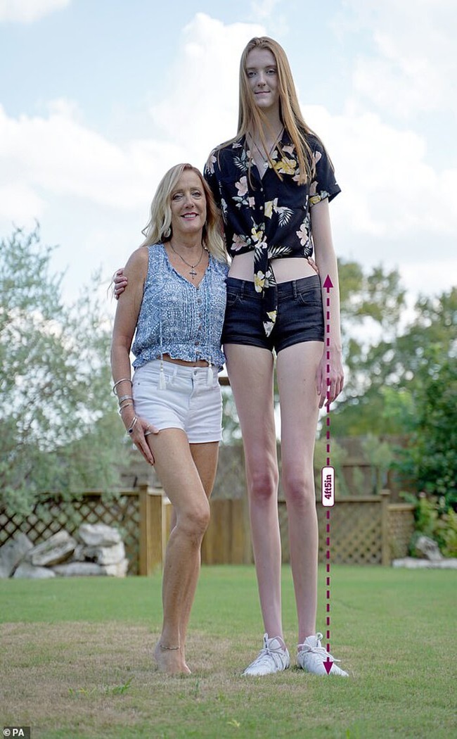 Cộng đồng mạng - Thiếu nữ Mỹ xinh đẹp 'vượt mặt' ngôi sao bóng rổ người Nga, 'soán ngôi' đôi chân dài nhất thế giới (Hình 2).