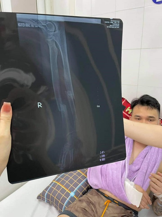 Tin tức giải trí - Khắc Việt chấn thương nặng ở cả hai tay, đang được cấp cứu tại bệnh viện (Hình 2).