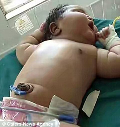 Ngỡ ngàng với bé gái sơ sinh nặng nhất thế giới - Ảnh 4