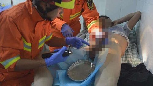 Lính cứu hỏa toát mồ hôi khi dùng máy cắt cờ lê giải cứu cậu nhỏ của người đàn ông - Ảnh 1