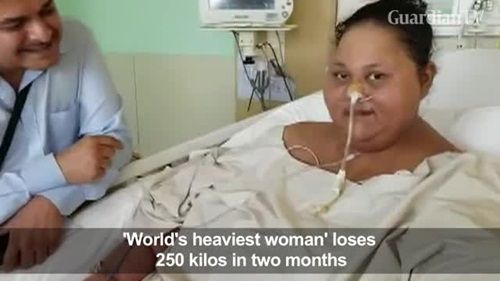Người phụ nữ gây bất ngờ khi giảm 250kg sau 2 tháng - Ảnh 3
