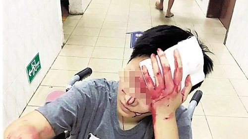 Trung Quốc: Bị đánh vỡ đầu vì phàn nàn khi bị giao đồ ăn chậm - Ảnh 1