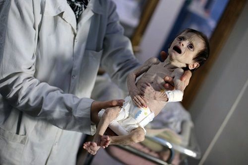 Đau xót trước hình ảnh em bé Syria nặng chưa đến 2kg vì đói  - Ảnh 1