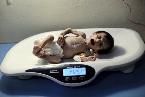 Đau xót trước hình ảnh em bé Syria nặng chưa đến 2kg vì đói  - Ảnh 2
