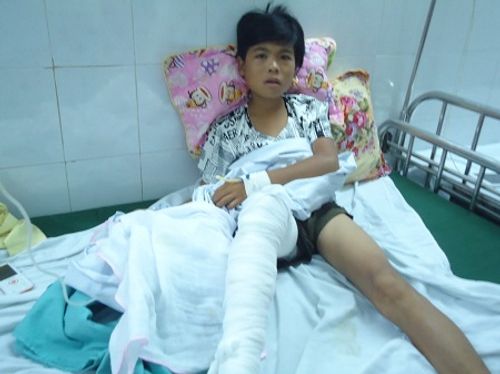 Bé trai 13 tuổi nghi bị hổ vồ mất bắp chân - Ảnh 1