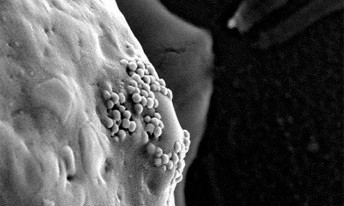 Thực hư thông tin tế bào gốc, nano vàng chữa được ung thư - Ảnh 1